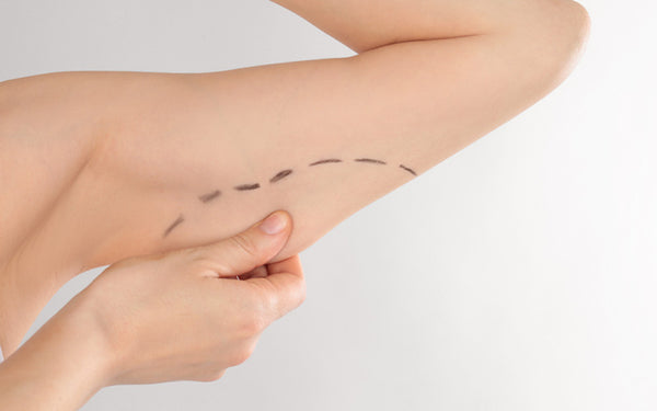 Alternatives To Arm Lift Surgery
