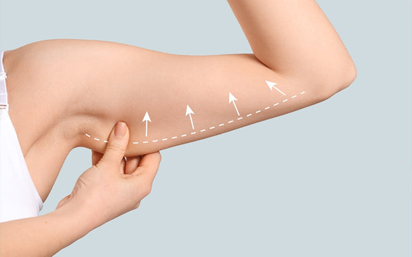 Understanding Arm Liposuction