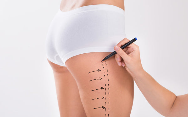 Understanding Thigh Liposuction And Its Techniques