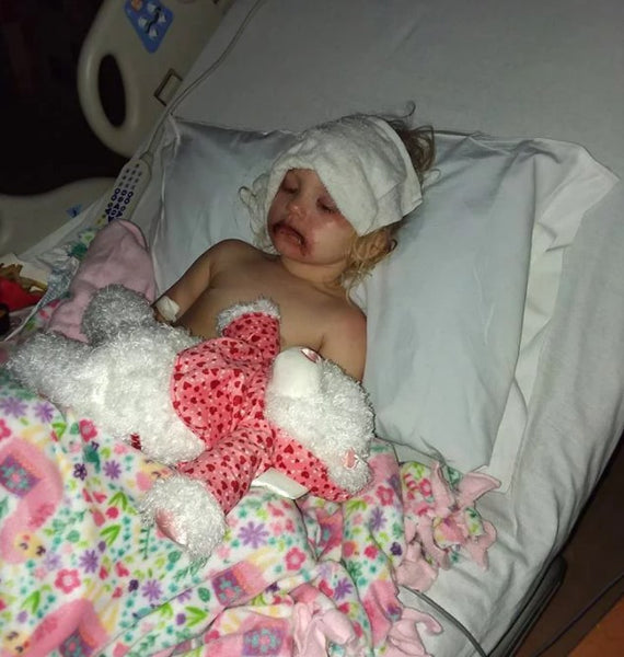 3-Year-Old Hospitalized with Severe Blisters After Playing with Toy Makeup Kit Begins Recovery