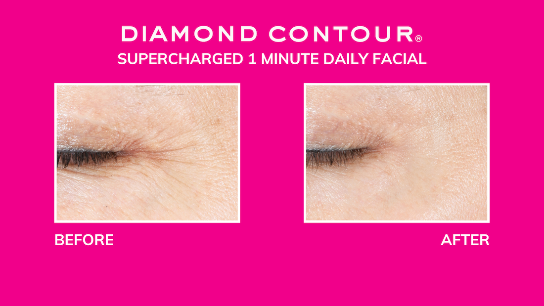 Results of the Diamond Contour Supercharged 1-Minute Daily Facial
