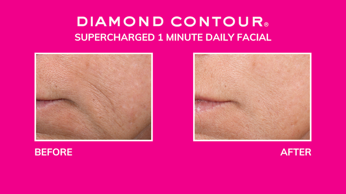 Diamond Contour Supercharged 1-Minute Daily Facial