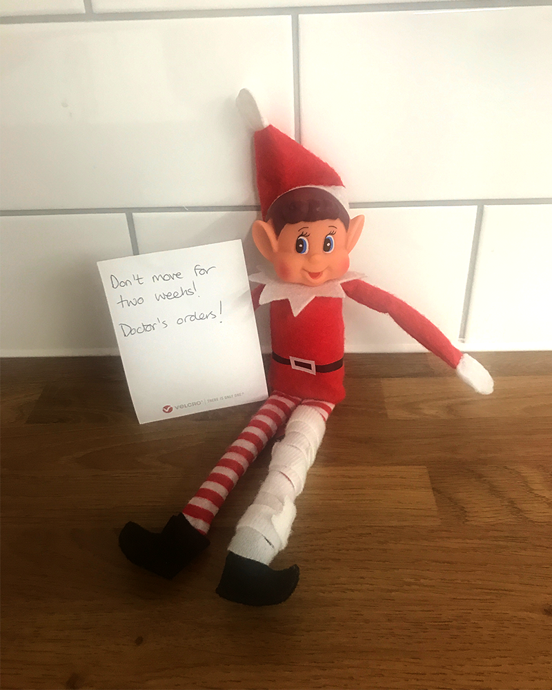 Elf on the Shelf - Broken Leg