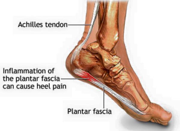 pain in the ankle and heel in the morning