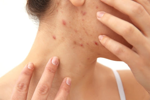 chronic skin conditions