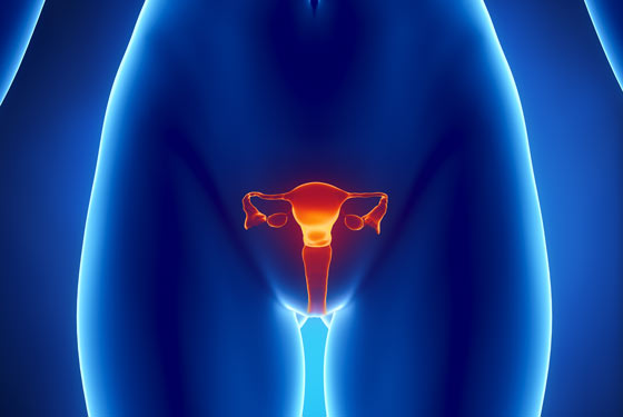 How to treat Endometriosis