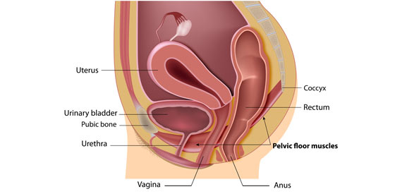 Stress urinary incontinence (SUI) is a common condition that affects m, Strengthen Pelvic Floor