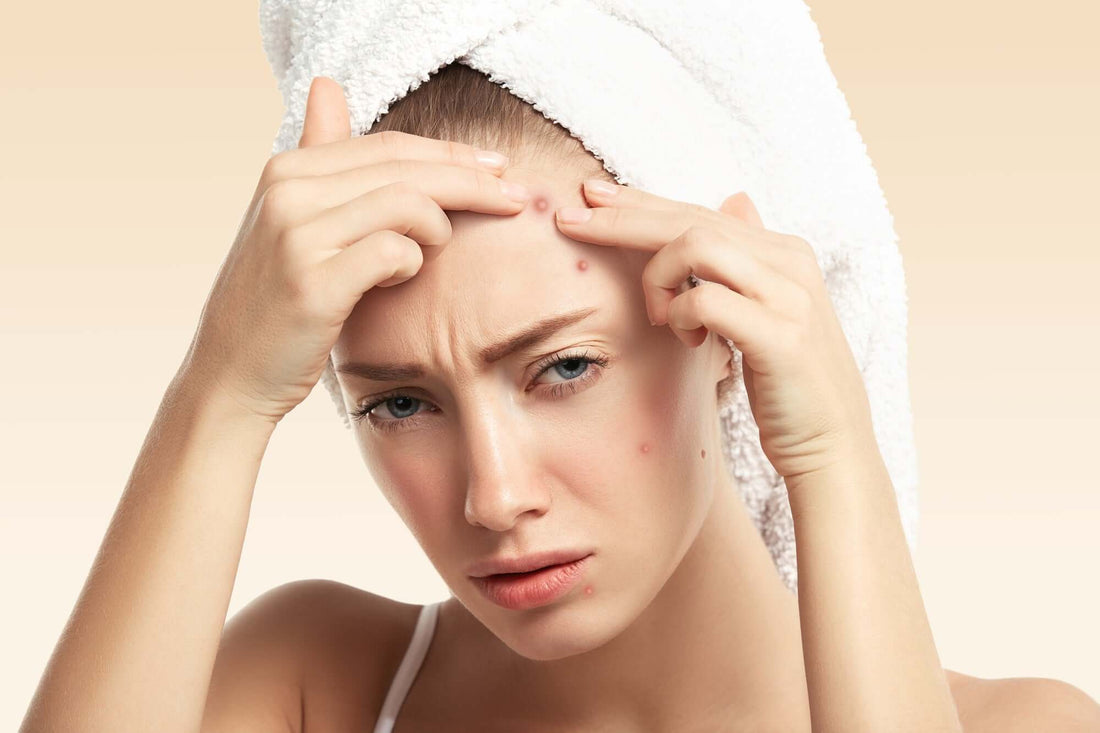 Acne Treatment: Does Red Light Therapy Help With Acne?