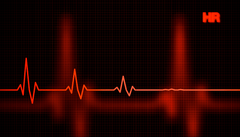 Congestive heart failure