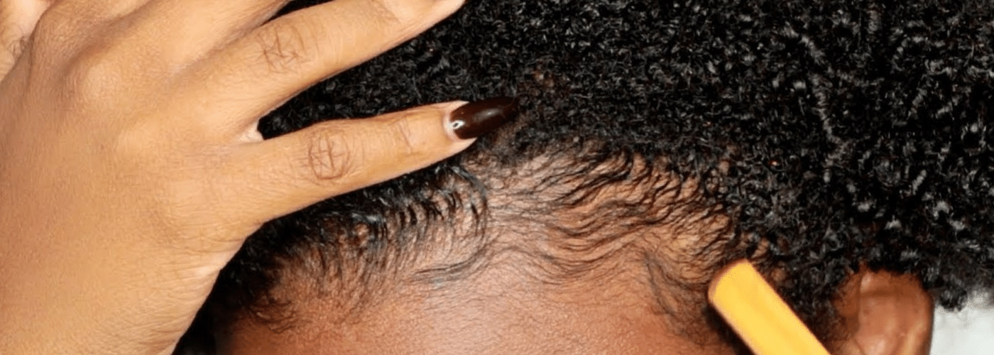 How to Grow Black & Afro Hair Fast! (15 Natural Methods) – Equi