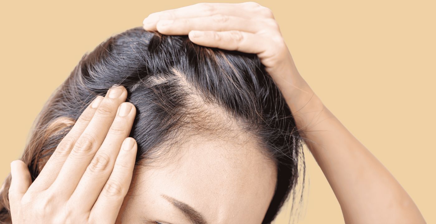 What are the reasons for hair thinning in women  Traya