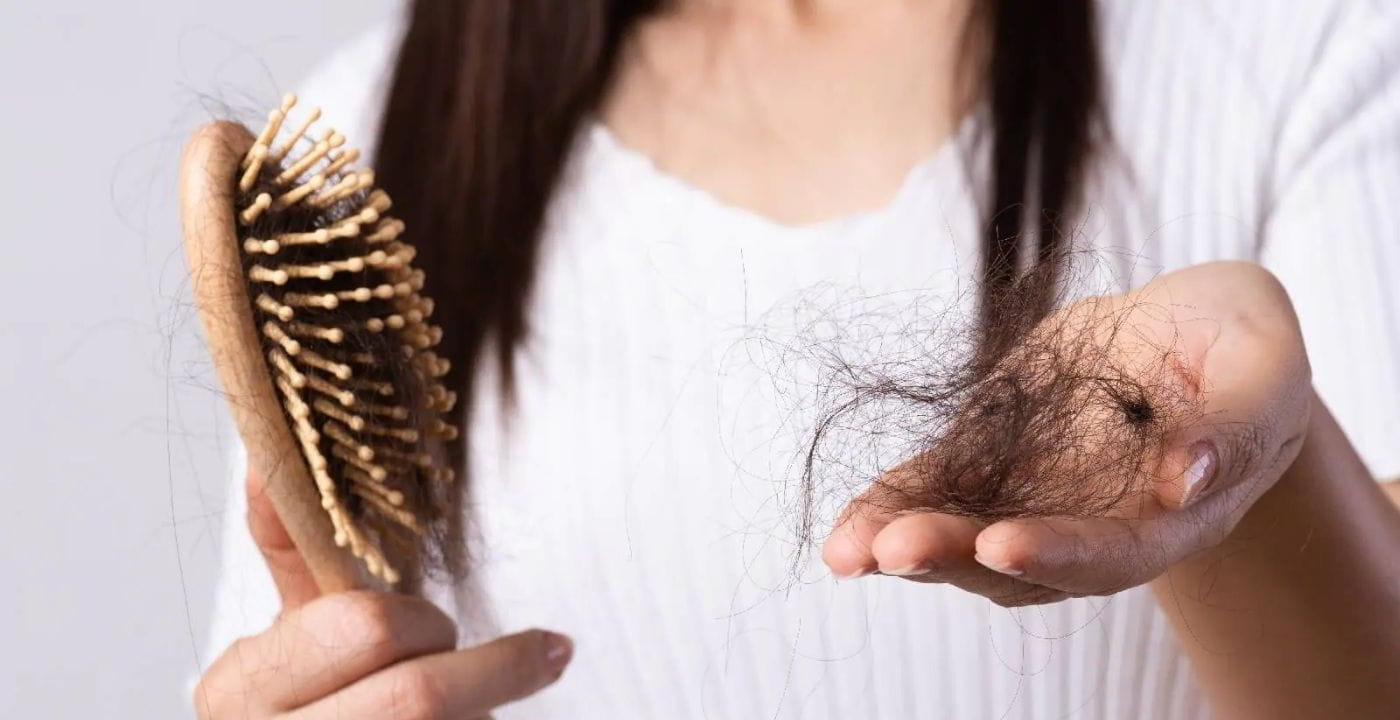 Know About Hair Fall Types Causes and Its Treatments