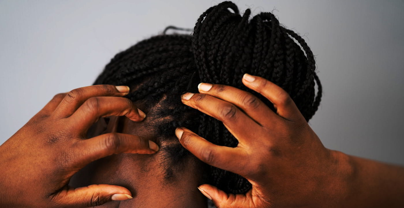 How to Tell If Traction Alopecia Is Causing Your Hair Loss | Allure