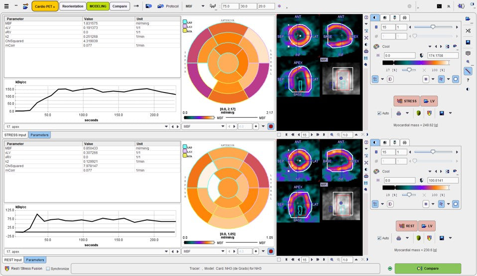 PCARDP Cardiac PET Analysis  (Remote)