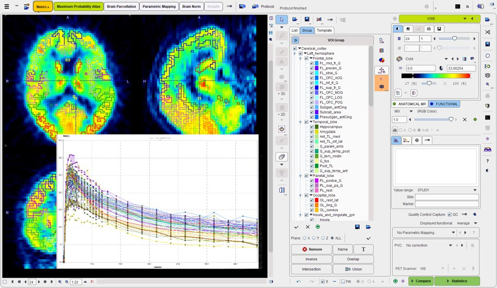 PNEURO Human Brain Analysis (Remote)