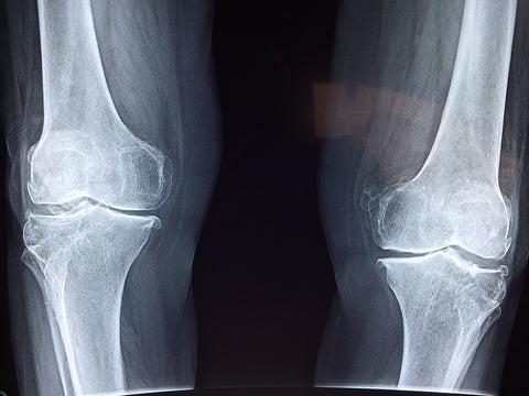 Knee Joint