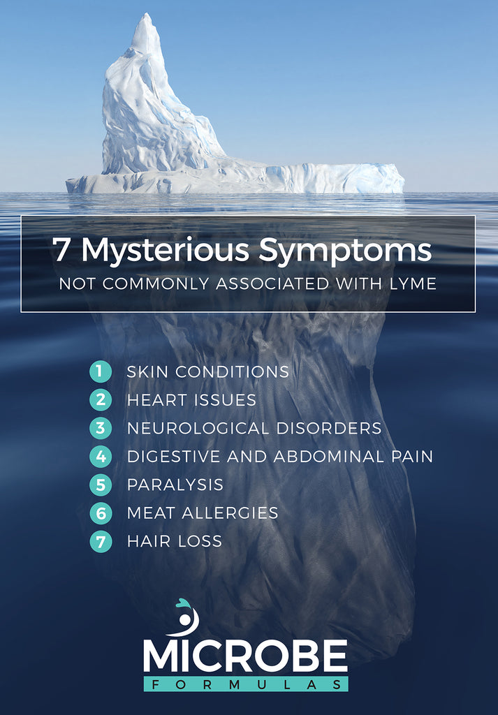 7 Mysterious Symptoms Not Commonly Associated With Lyme