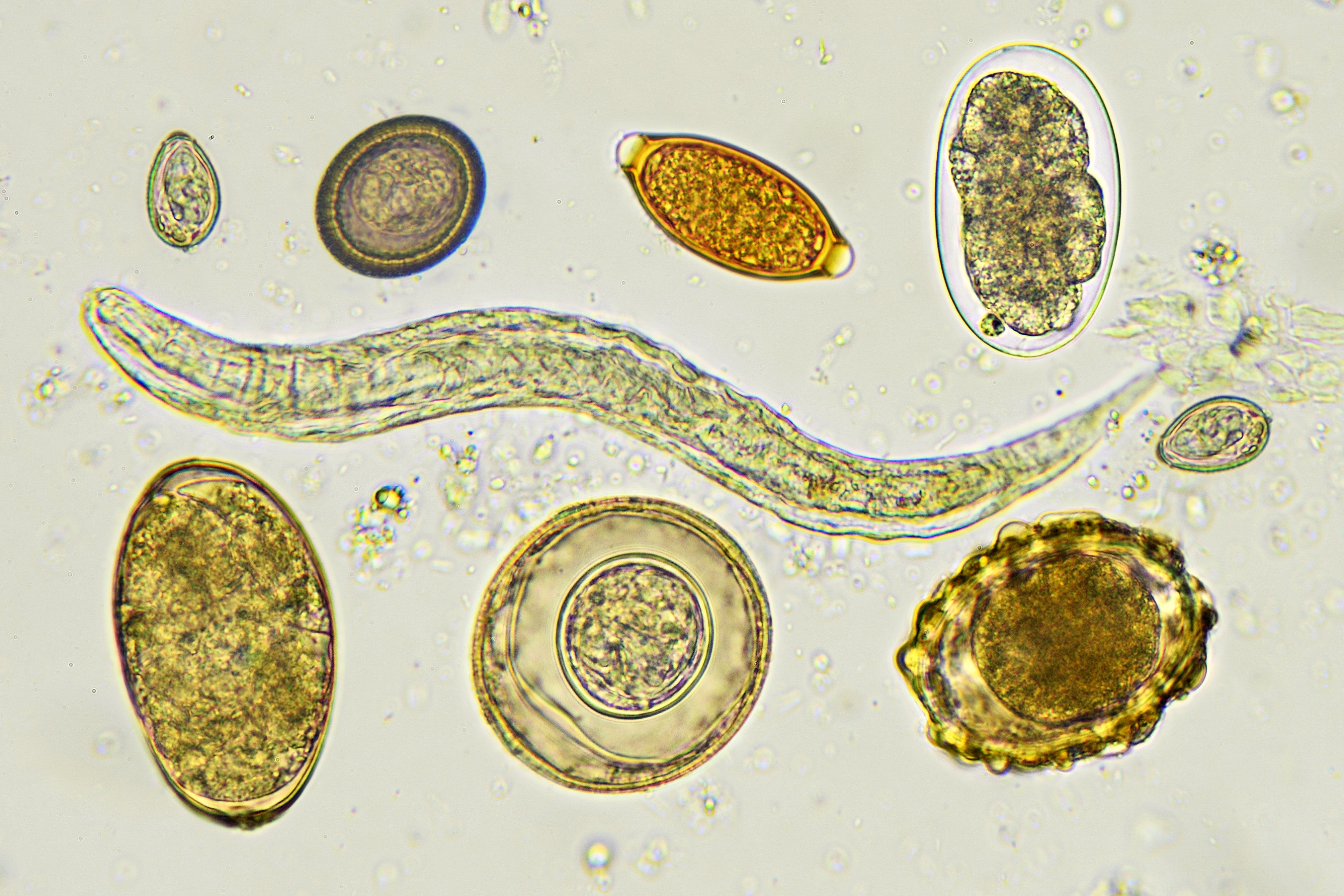 Споры в кале у взрослого. Микроскопия кала яйца гельминтов. Цисты лямблии микроскопия. Цисты лямблий микроскопия кала. Яйца и цисты гельминтов.