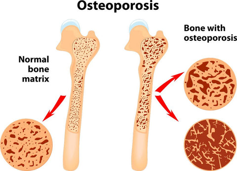 cannabidiol osteoporosis