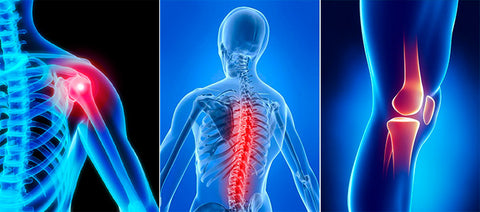 CBD and Joint Pain