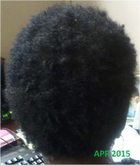 Naturaz Hair Thick Hair After Alopecia