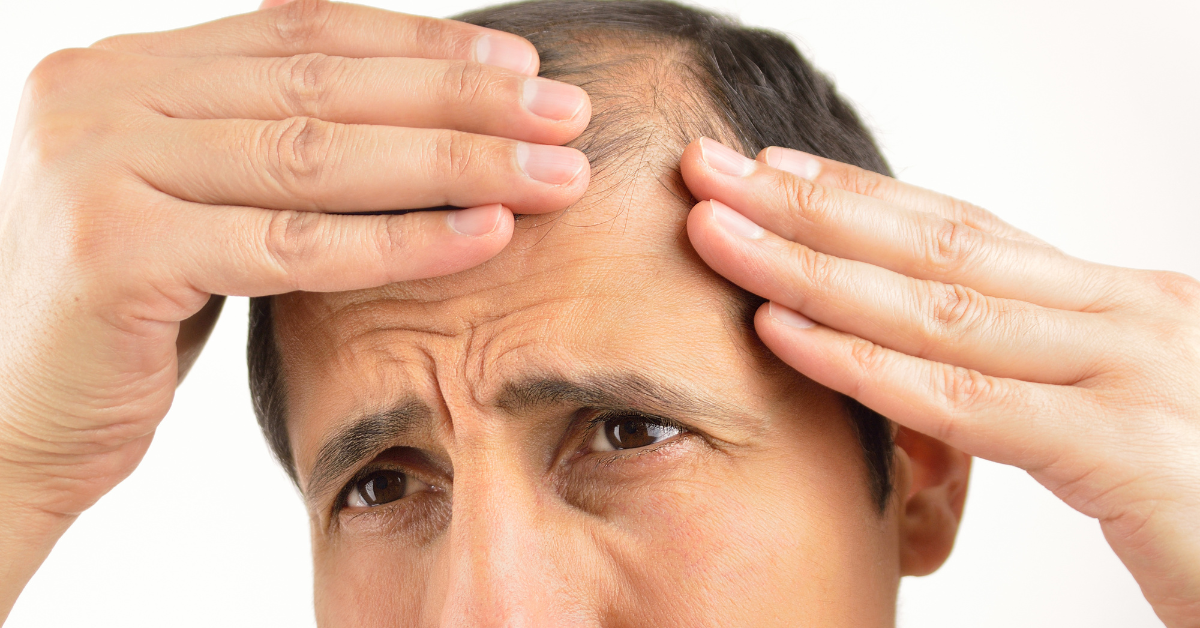 man checking hair loss 