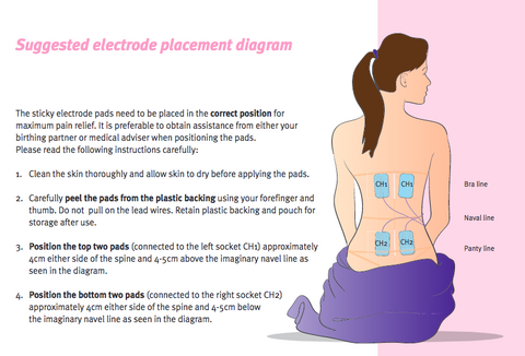 Using a TENS Unit During Labor