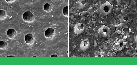 Tubule Occlusion before and after brushing with BioMin™ F.