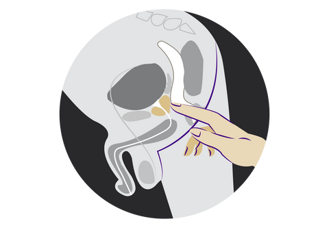 illustration of male anatomy with finger on prostate