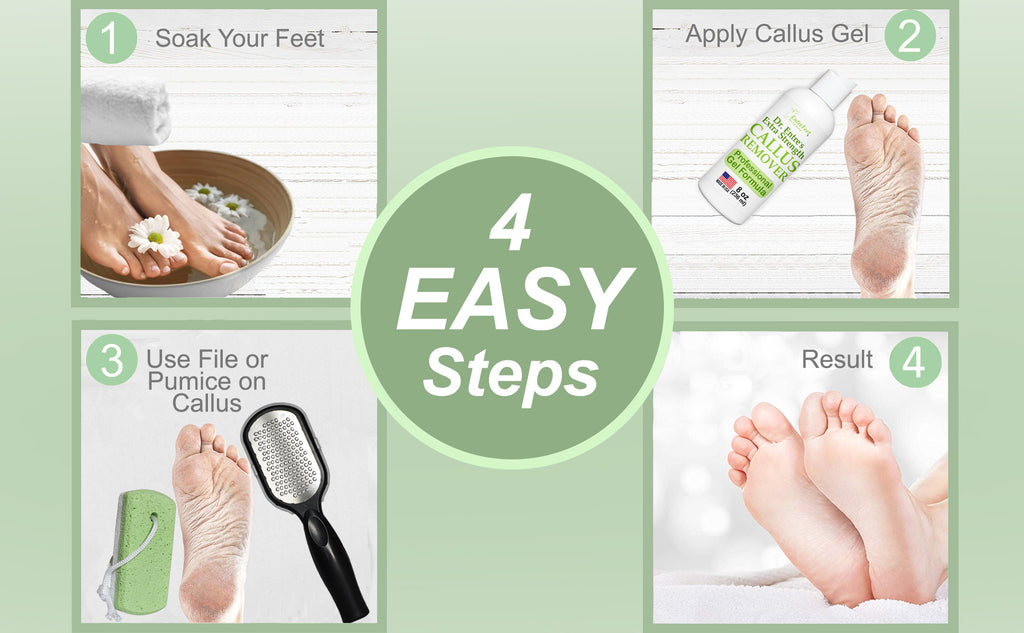 Dr. Entre's Pumice Stone for Feet 4 Pack: Callus Remover Dead Skin Scraper Exfoliator for Scrubber Use Pedicure Tools Cracked Heels Foot Care