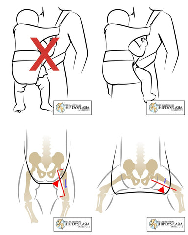 hip support for carrying baby