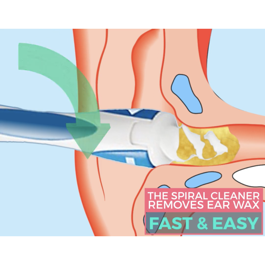 Spiral Ear Wax Remover With 16 Tips Healthsona