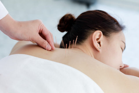 Go for Acupuncture Therapy