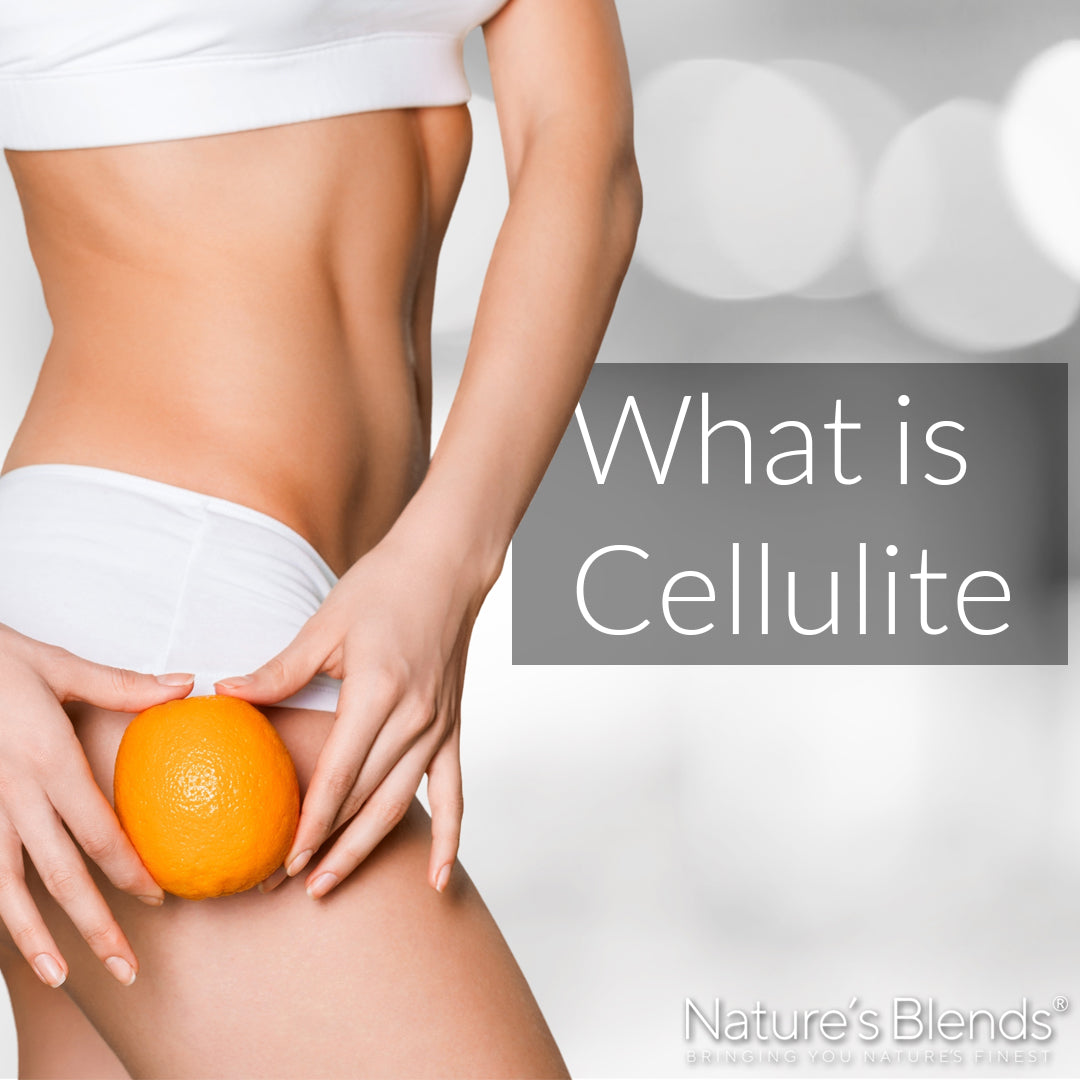 What is cellulite and its causes