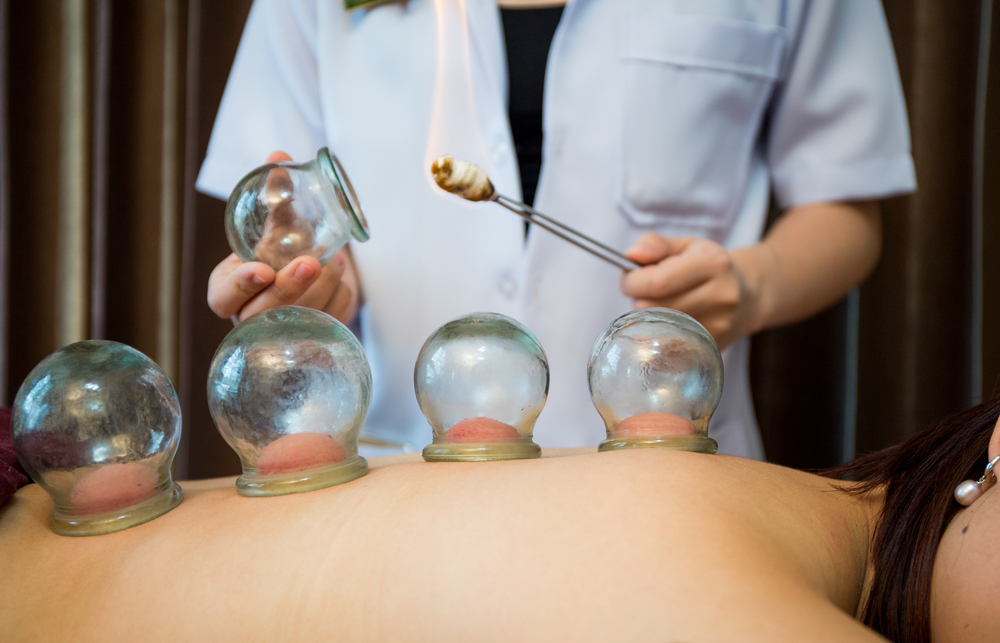 Cupping Benefits for Athletes