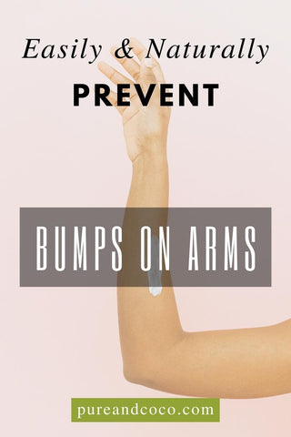 a woman's smooth arm free from keratosis pilaris by pure and coco