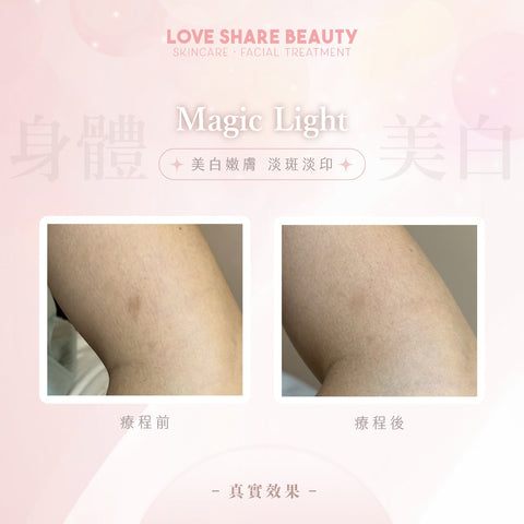 Love Share Beauty | 美白身體皮膚