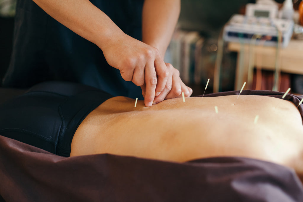 acupuncture and the menopause 