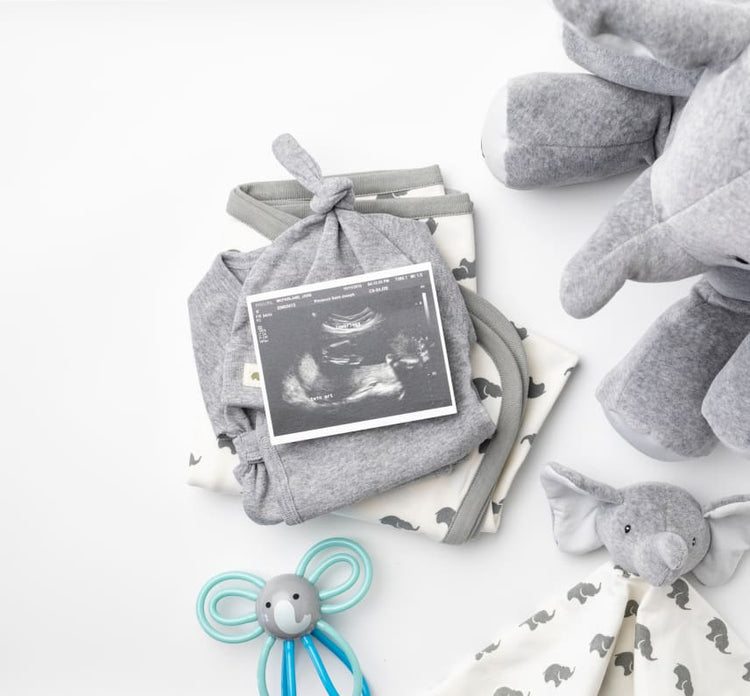 Plush toys surrounding ultrasound picture