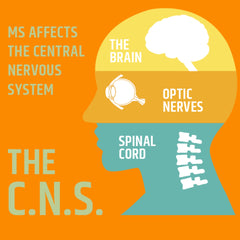 MS affects CNS
