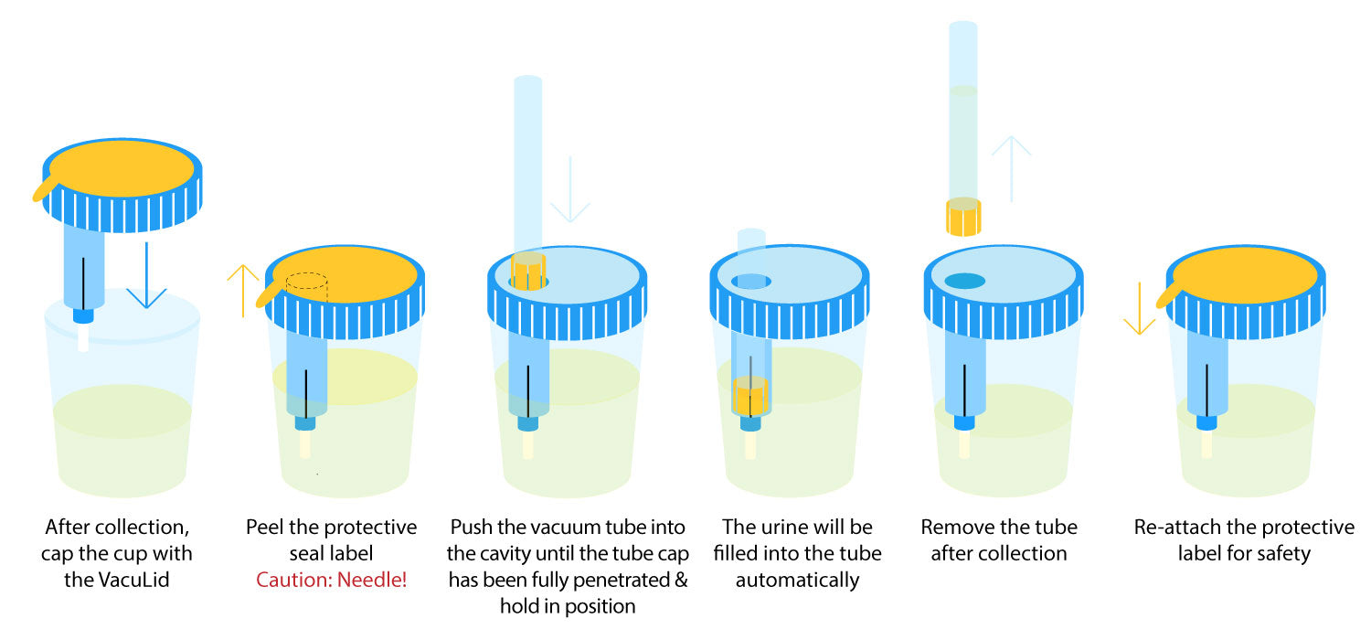 Sample collections. Urine Testing infographic. Urine z инструкция по применению на русском языке. Magic Mushrooms urine Test. Methods to collect the urine from children.