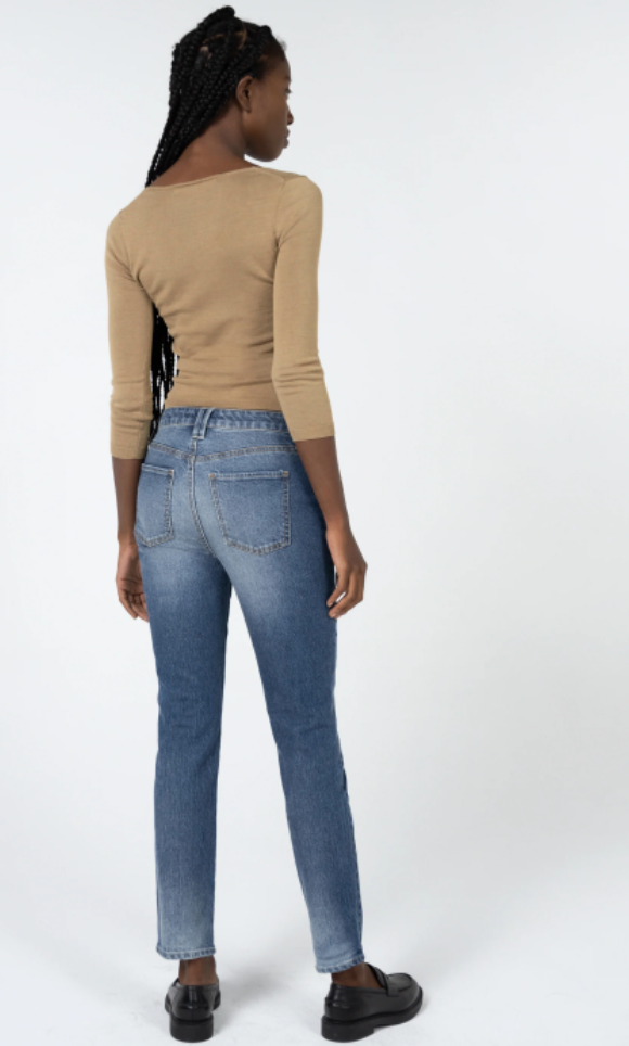 PDF] Pernio of the hips in young girls wearing tight-fitting jeans with a  low waistband.