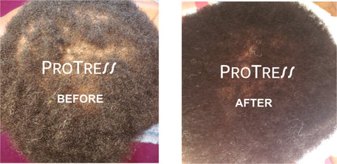 hair loss caused by curling sponge restored with treatment