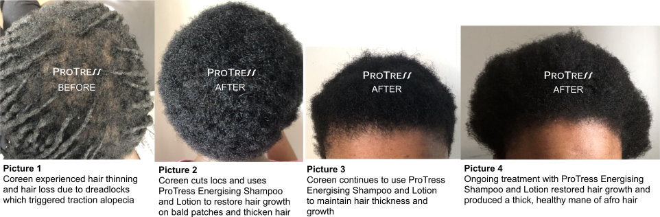 shampoo that thickens thin afro hair