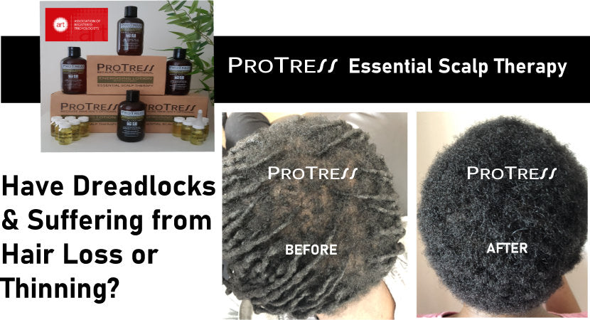 have dreadlocks and suffering from hair loss or thinning? How to stop hair loss if you have dreadlocks