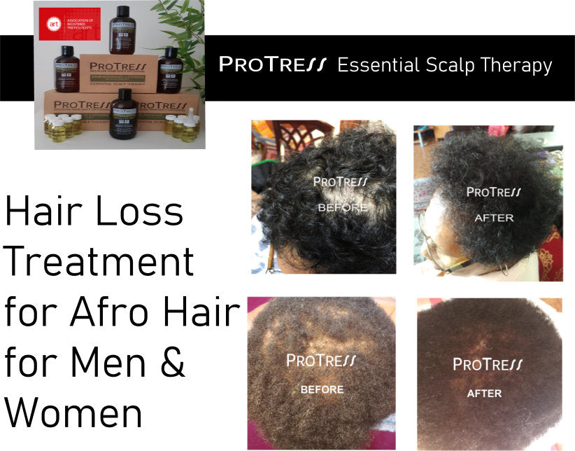 hair loss treatment for afro hair for men and women