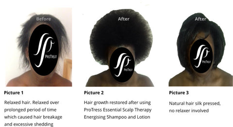Treatment for hair loss caused by relaxer