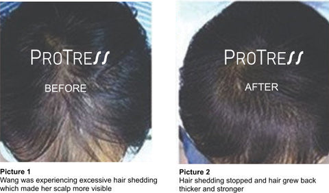 hair loss caused by pollution 