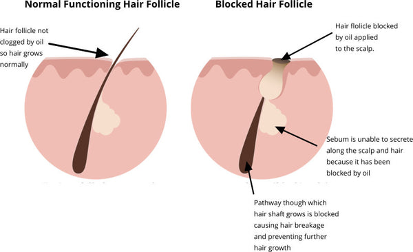 oil blocking hair follicle causing hair breakage