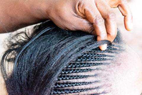 cornrows which are too tight can cause traction alopecia